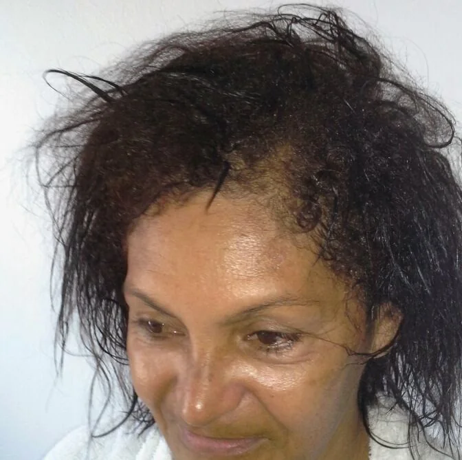 Resultado real de cliente Brumar, antes e depois